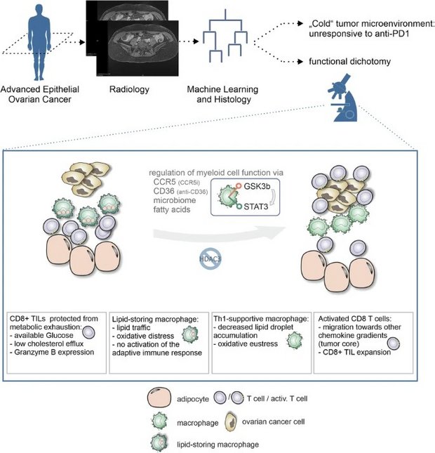 "Graphical Abstract depicting the workflow of radiological and machine learning based histological analysis of ovarian Cancer samples to study lipid-driven immune regulation, showing interactions between macrophages, CD8+ T cells, and tumor cells in the tumor microenvironment